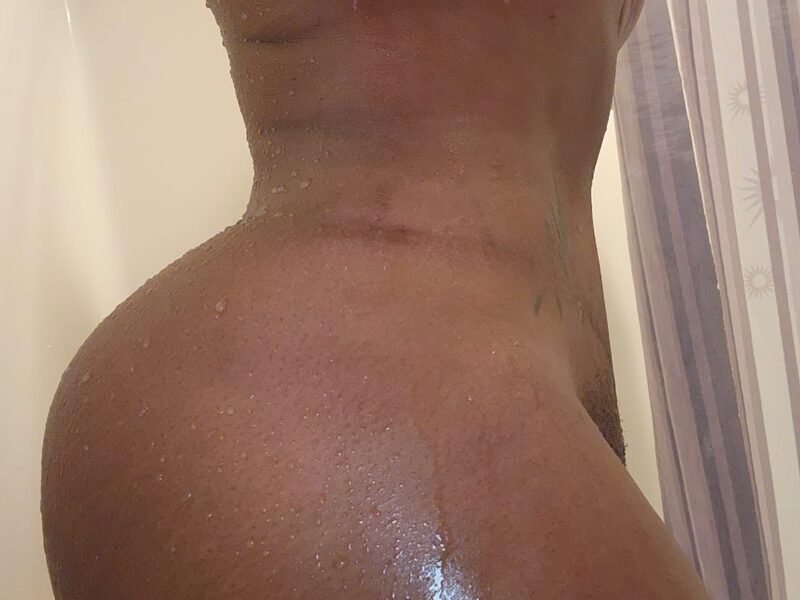 Breast lift with implants + liposuction + bbl